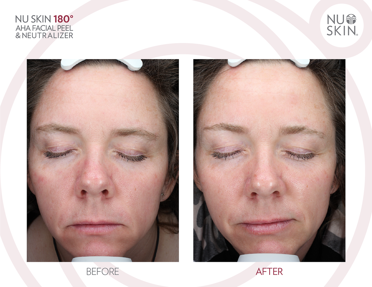 Nu Skin 180 AHA Peels