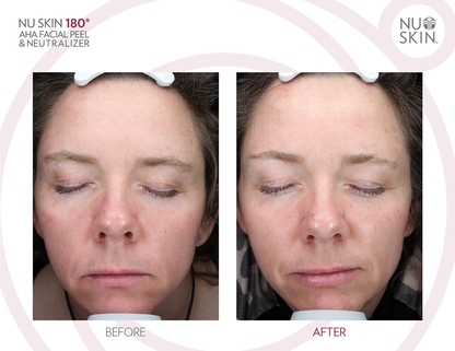 Nu Skin 180 AHA Peels