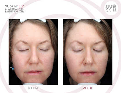 Nu Skin 180 AHA Peels