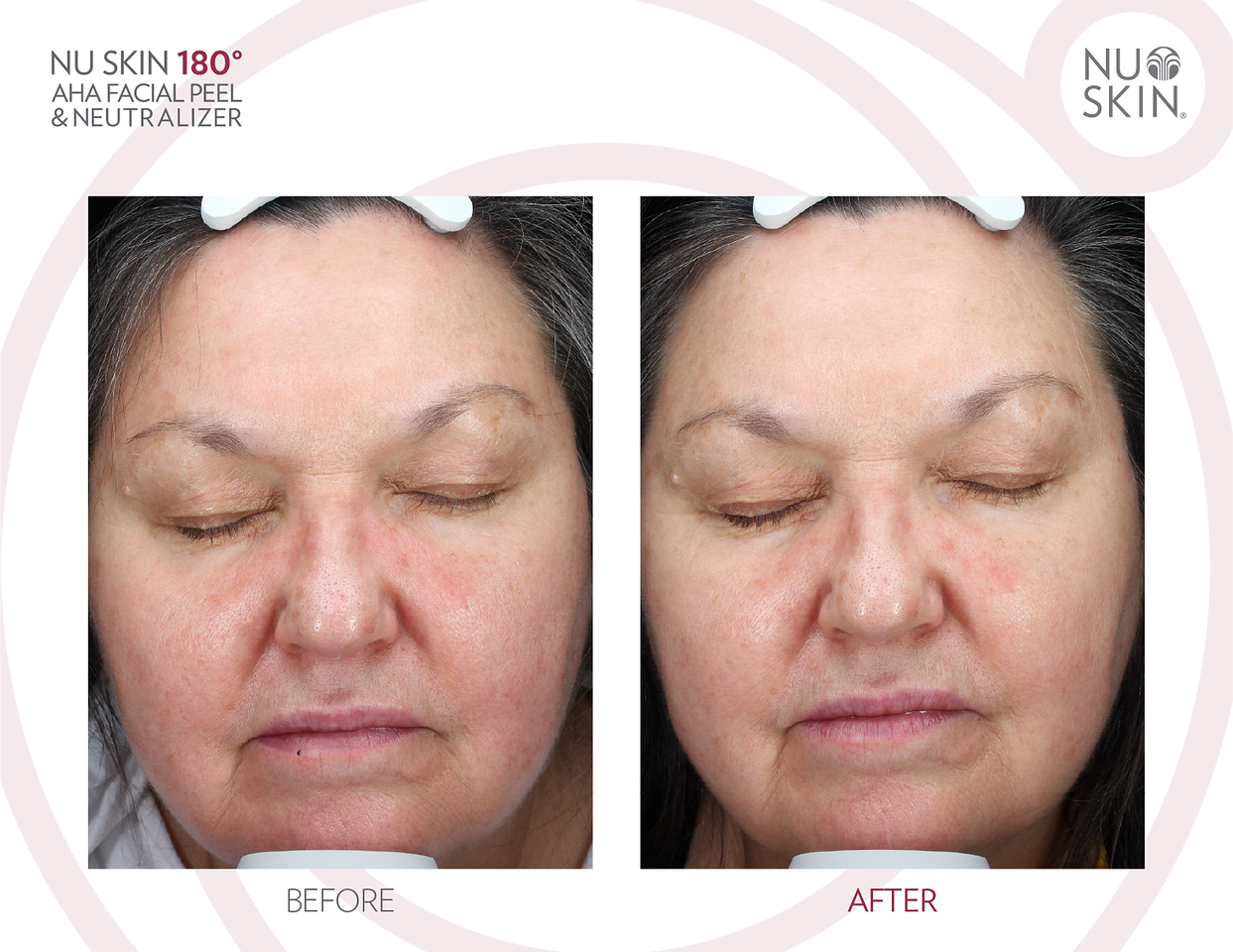 Nu Skin 180 AHA Peels