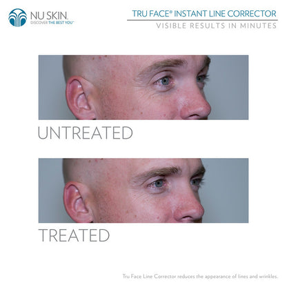 Truface Line Corrector