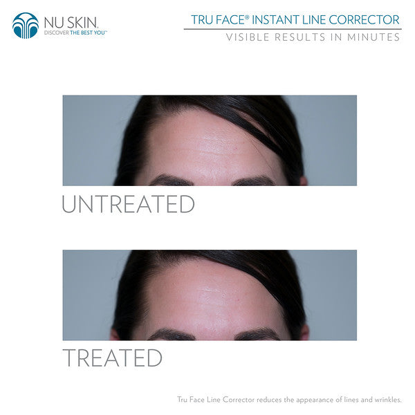 Truface Line Corrector