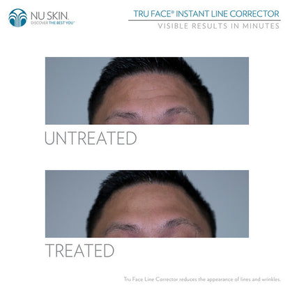 Truface Line Corrector