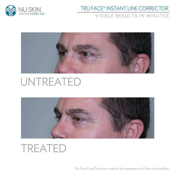 Truface Line Corrector