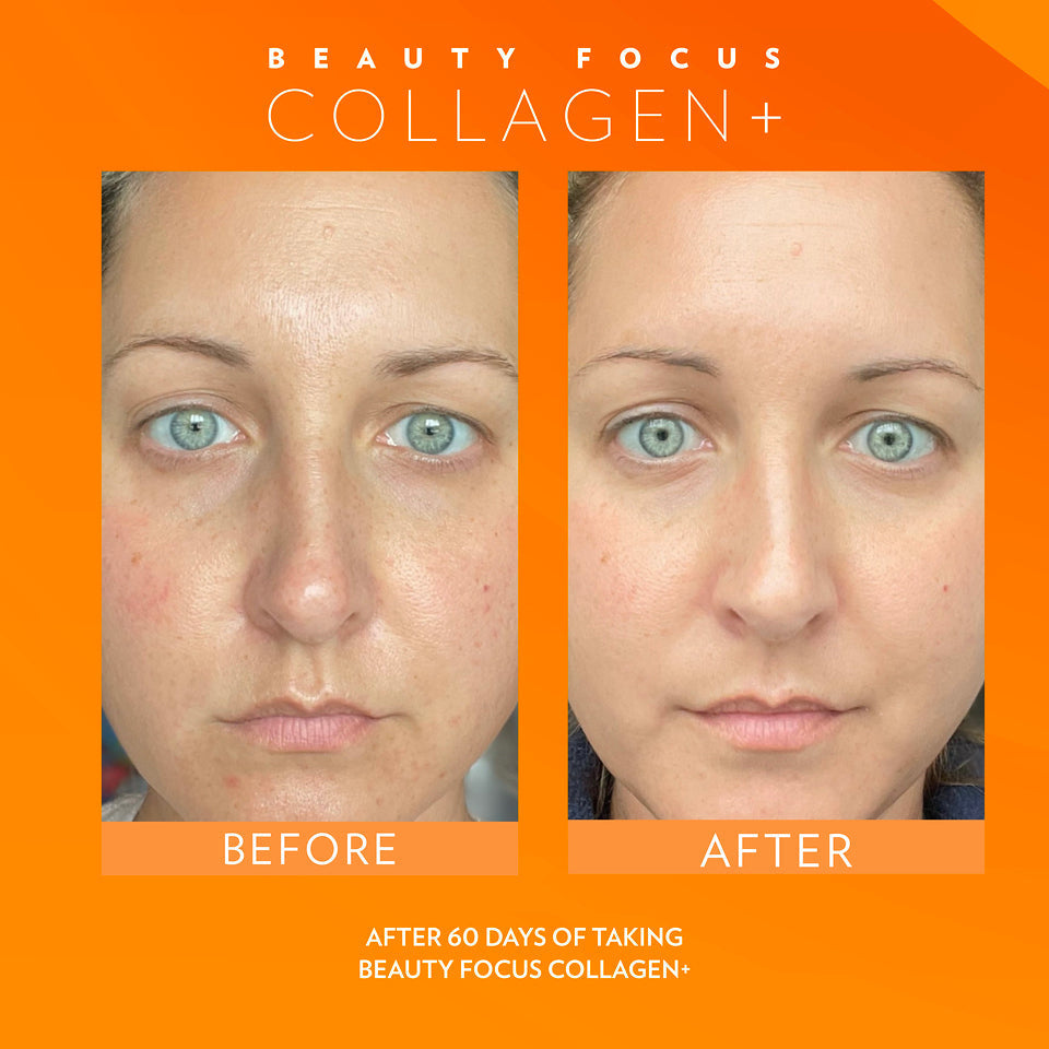 Beauty Focus Collagen+ 30-Day Supply