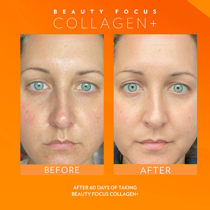 Beauty Focus Collagen+ 30-Day Supply