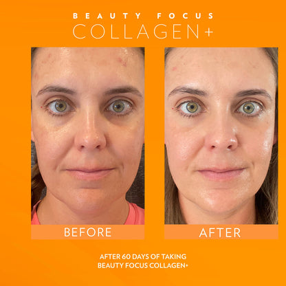 Beauty Focus Collagen+ 30-Day Supply