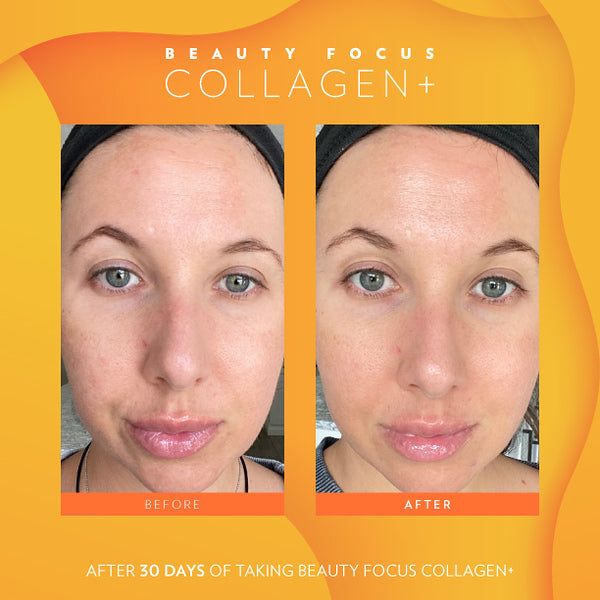 Beauty Focus Collagen+ 30-Day Supply